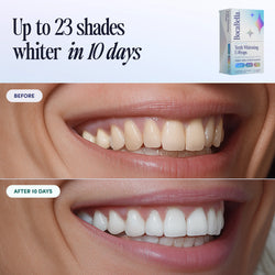 Teeth Whitening U-wraps