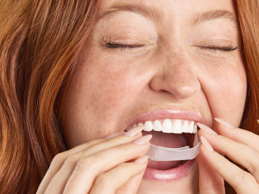 Applying the U-Wraps to the teeth