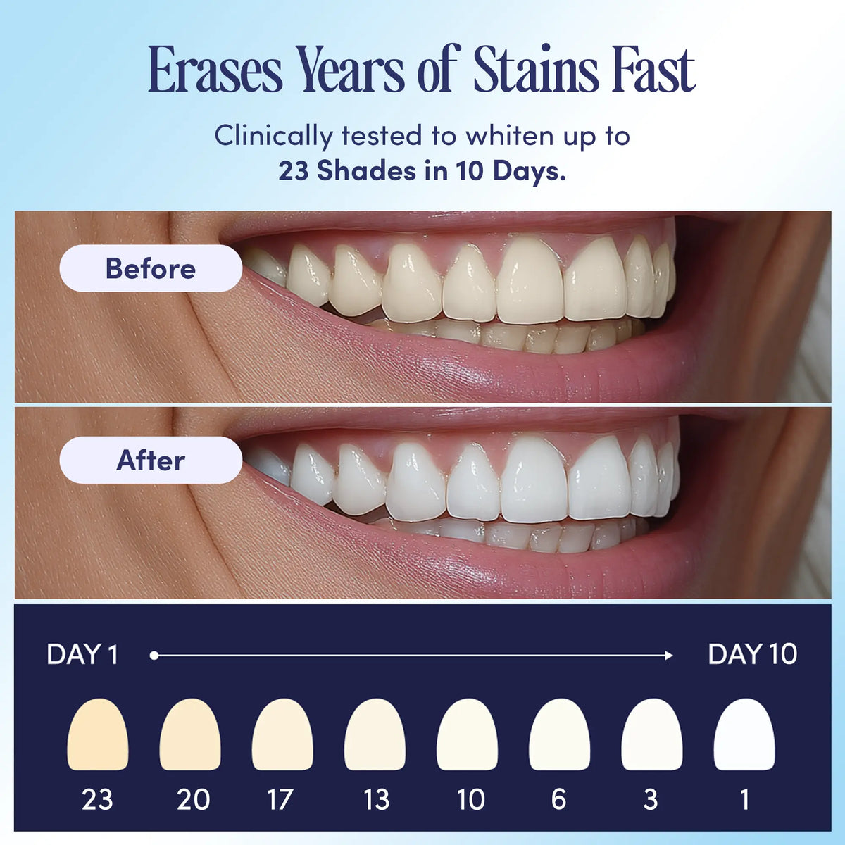 Teeth Whitening U-wraps